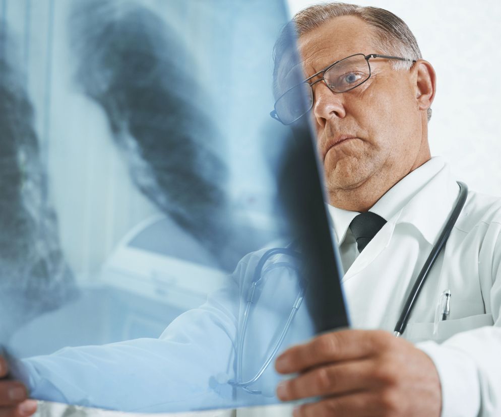 Odma śródpiersiowa ma zwykle łagodny przebieg.