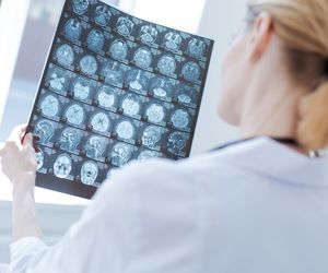 Zespół von Hippla-Lindaua: przyczyny, objawy, leczenie