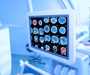 Brodawczaki splotu naczyniastego komór mózgu: objawy, leczenie