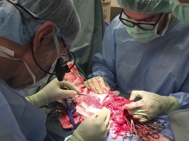 PIERWSZY TEGO TYPU PRZESZCZEP.