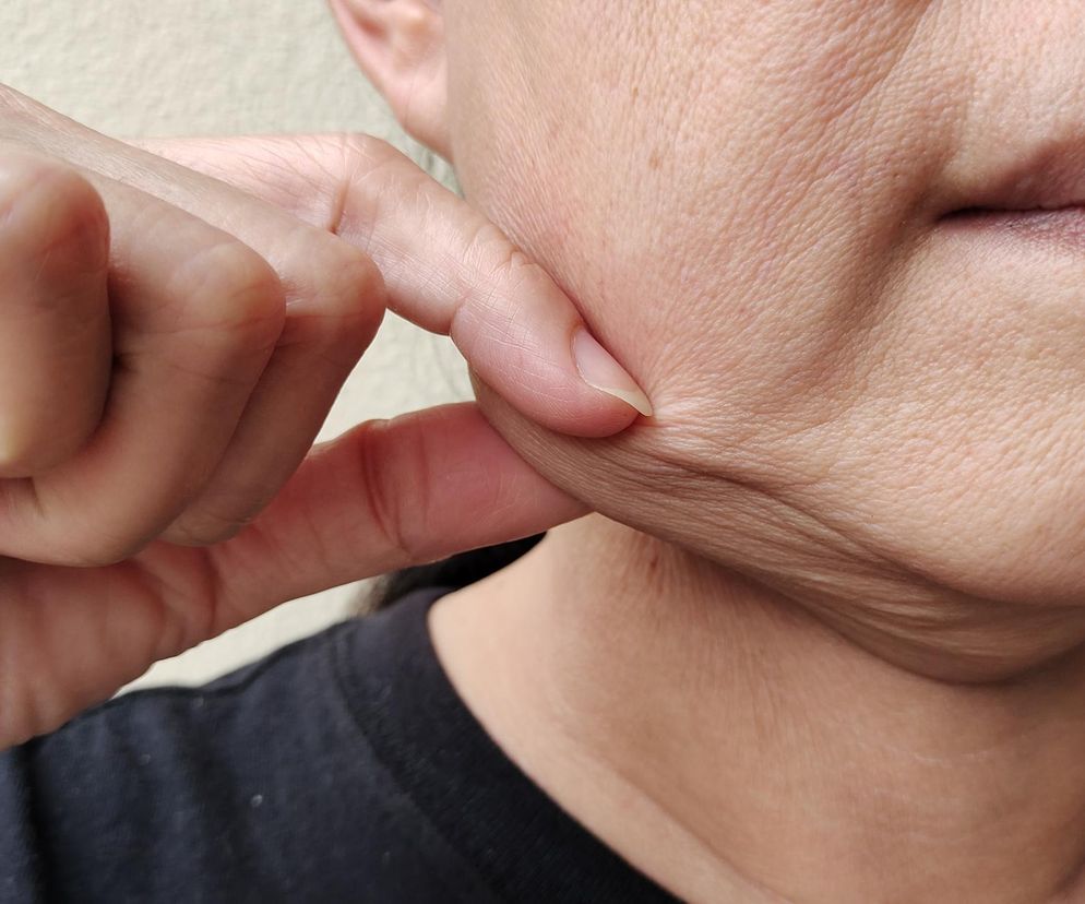 To się stanie z twarzą, gdy żyjesz w stresie. Jak wygląda twarz kortyzolowa