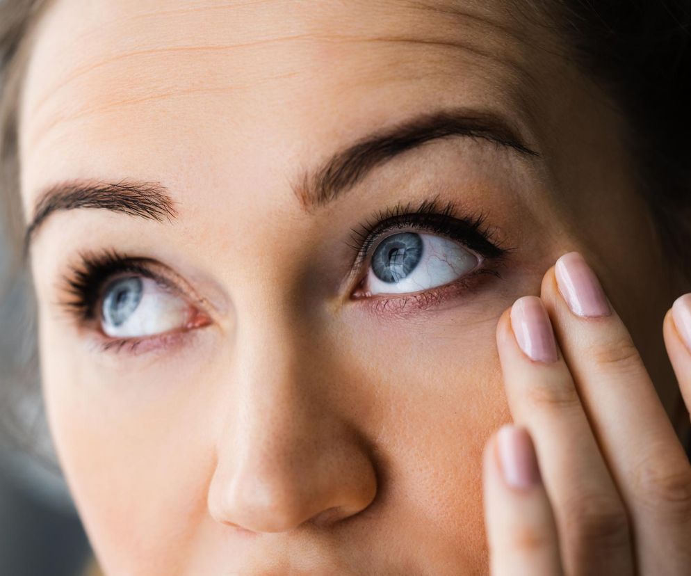 Choruje już co piąty Polak. Opuchnięte oczy i zaskórniki wśród pierwszych objawów