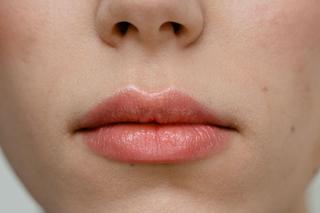 Domowe sposoby na opryszczkę. Pozbędziesz się jej nawet w jeden dzień!