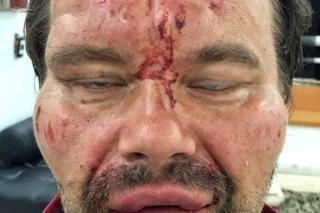 Pobili dziennikarza GW