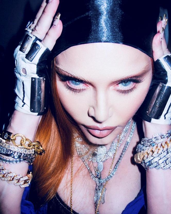  Madonna ma nową twarz! Nie sposób jej poznać. Chirurg ujawnia, co zrobiła