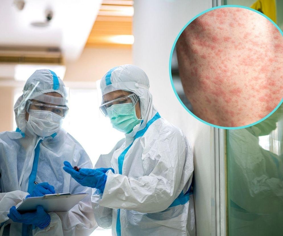 WHO ostrzega przed kolejną epidemią. „Może przerodzić się w tysiące zgonów”