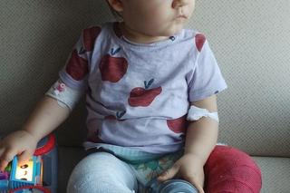 Wiktorek potrzebuje naszej pomocy! Chłopczyk urodził się z rzadką wrodzoną wadą nóżek