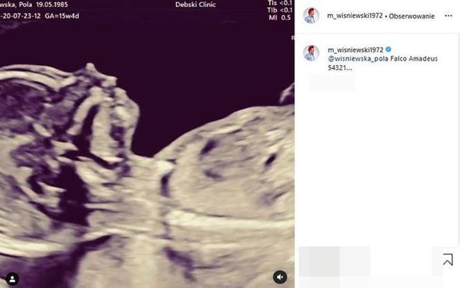 Michał Wiśniewski i Pola Wiśniewska zostali rodzicami