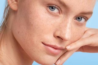 1 francuski krem na 5 problemów skórnych. Warto mieć go zawsze pod ręką