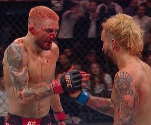 Zmasakrowana twarz gwiazdy UFC! Od tych zdjęć aż robi się słabo. To była krwawa rzeźnia w klatce