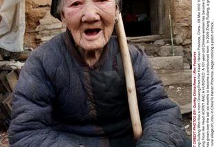 Chiny: Staruszce wyrósł róg na czole (FOTY) 