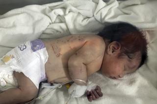 Urodziła dziecko w ruinach po trzęsieniu ziemi! Dziecko przeżyło, matka i ojciec zmarli