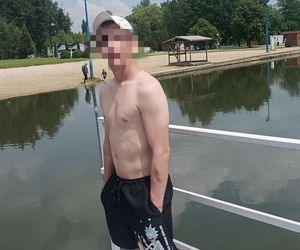 Horror na imprezie. Krystian został znienacka skatowany. Bandzior skakał mu po głowie