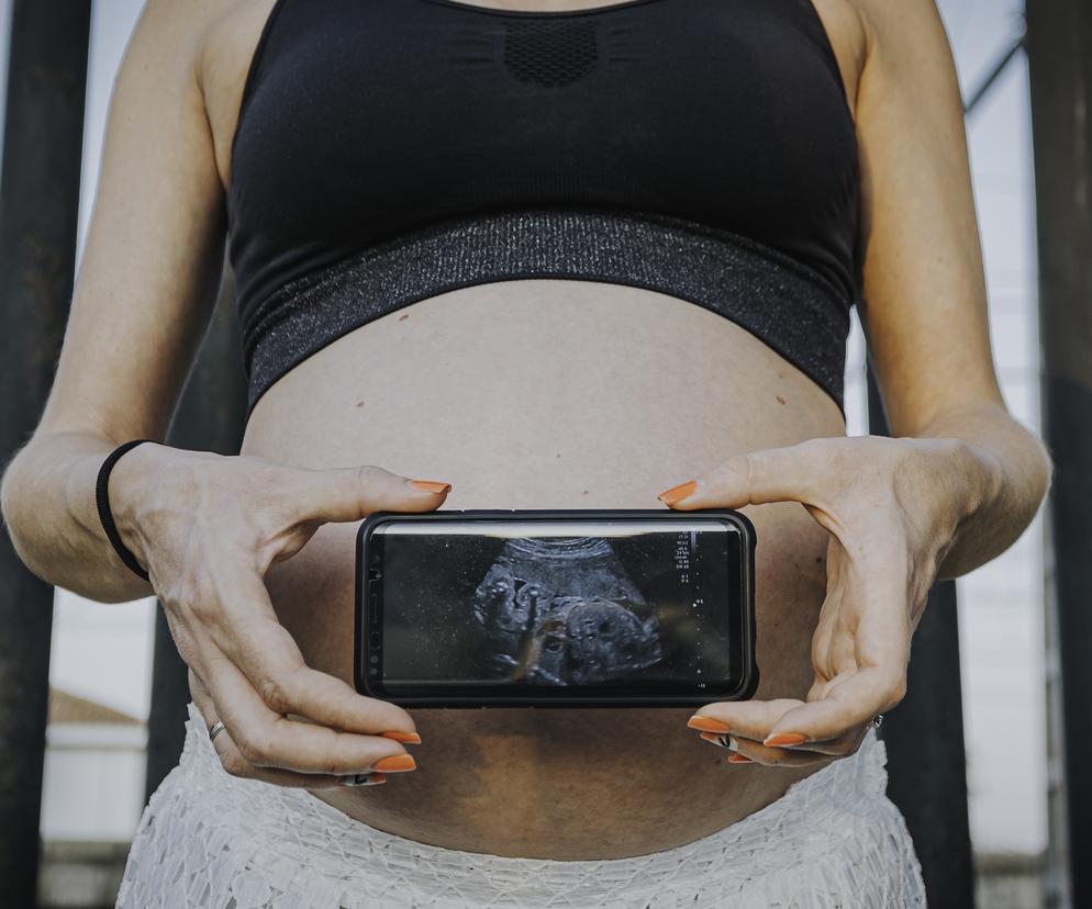 kobieta ze zdjęciem USG ciąży w telefonie 