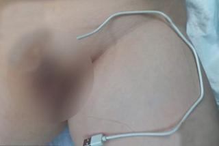 Wsadził sobie ładowarkę w penisa