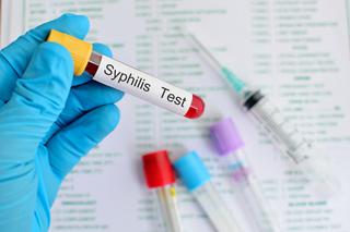 Badania na kiłę (syfilis) – jakie testy wykryją kiłę i kiedy je wykonać?