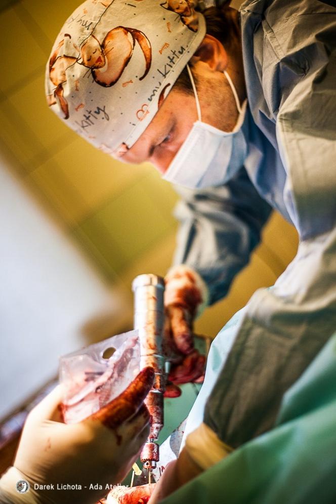 Dostał łapę z drukarki 3d