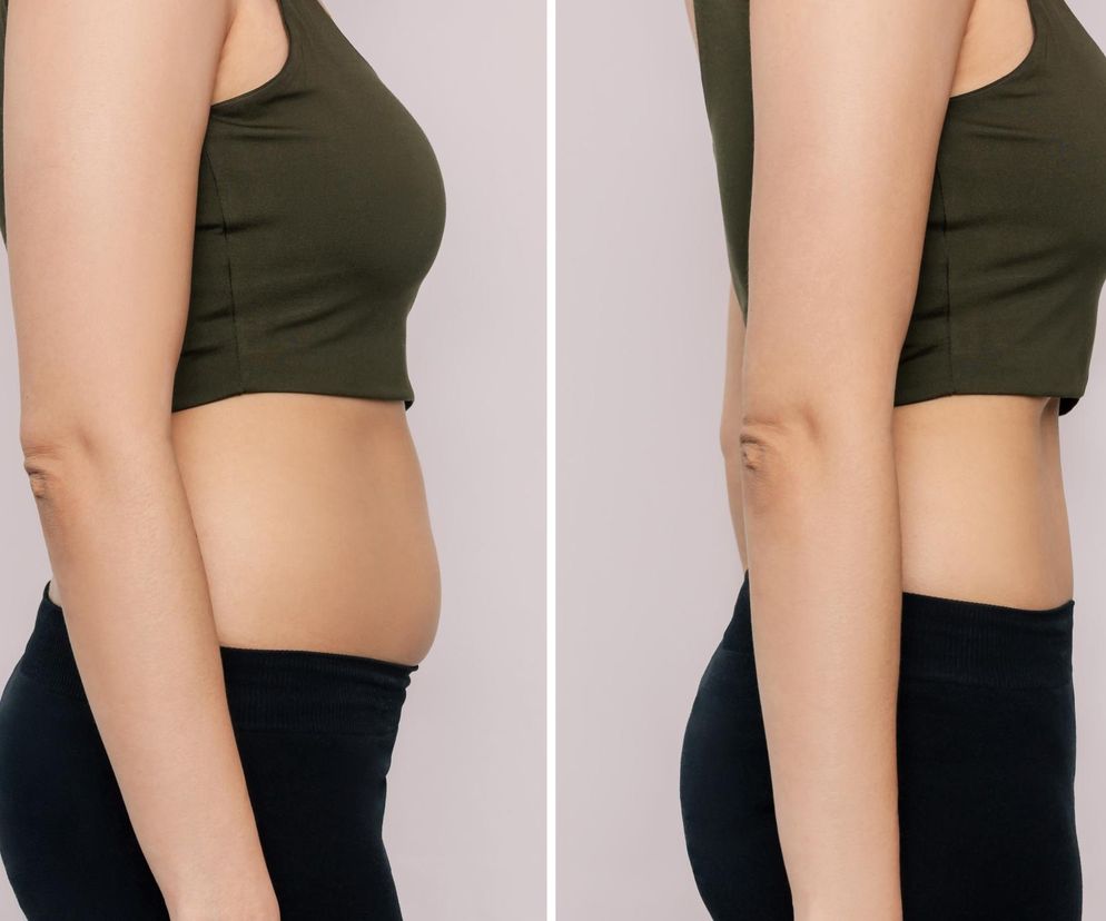 Technika vacuum polecana przez najlepszych trenerów. Brzuch płaski jak deska bez dużego wysiłku