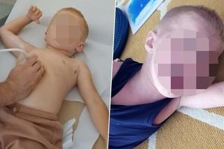 Łódź. Jedyna taka zbiórka w Polsce. Nawet rodzice małego Krzysia piszą o kontrowersjach [ZDJĘCIA].