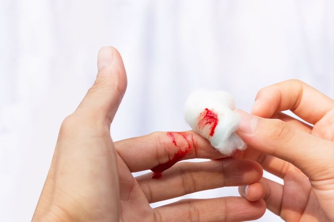 Hemostaza - przebieg. Zaburzenia hemostazy
