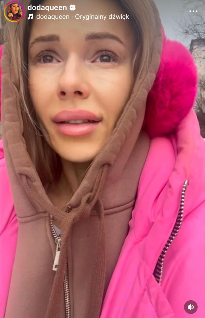 Doda pokazała bliznę po wycięciu czerniaka