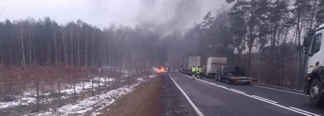 Auto spłonęło, 10-latek ciężko poparzony. Jego ciało pokryły przerażające blizny! [DRASTYCZNE ZDJĘCIA]