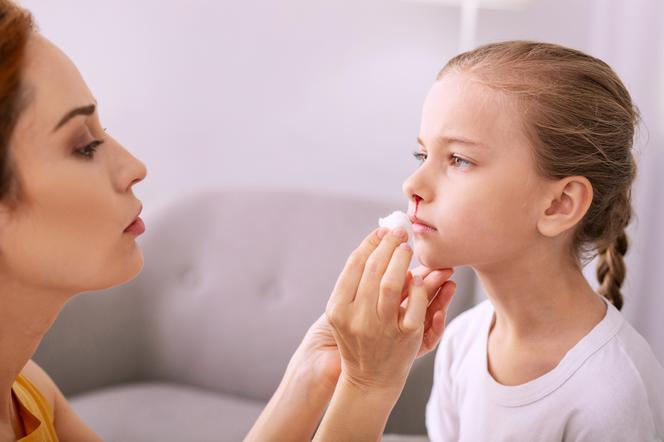 Przyczyny i postępowanie przy krwotoku z nosa u dzieci