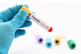 Filariozy: przyczyny, rodzaje, objawy, leczenie