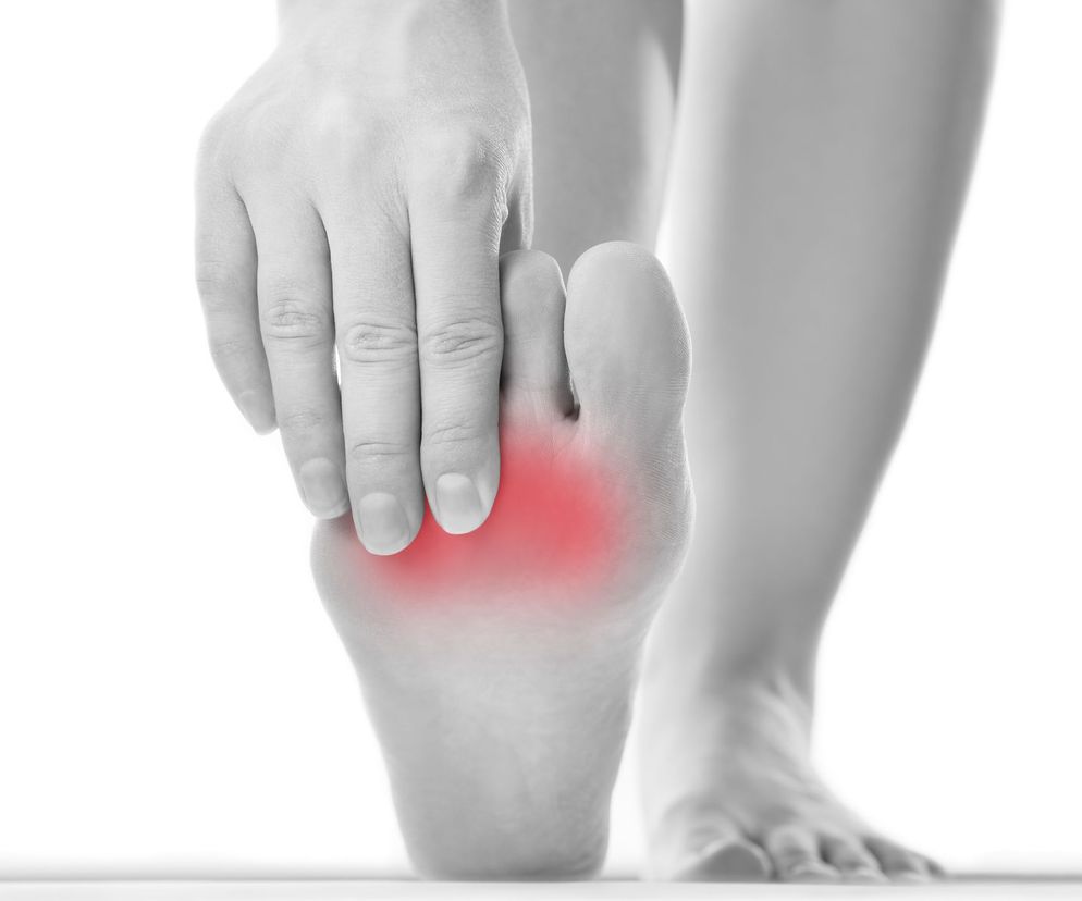 Metatarsalgia Mortona to zespół bólowy okolicy palca stopy. Kryje się pod różnymi nazwami: nerwiak Mortona, nerwiak międzypalcowy, neuralgia Mortona.