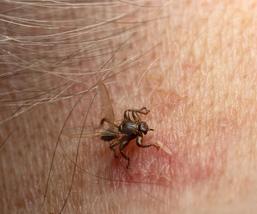 Strzyżaki już aktywne! Czy “latające kleszcze” gryzą? Czy mogą przenosić choroby?