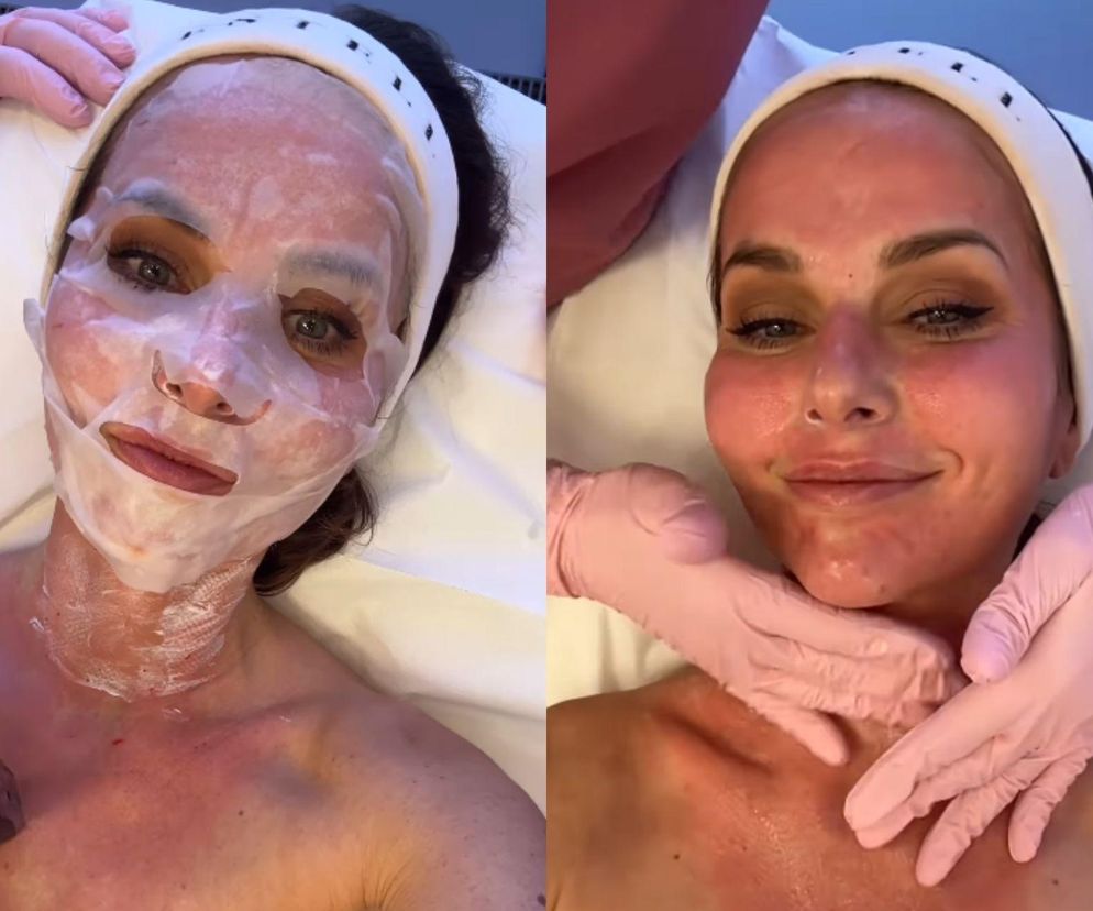 Paulina Sykut-Jeżyna o swoim ulubionym zabiegu kosmetycznym. Skóra w świetnej kondycji