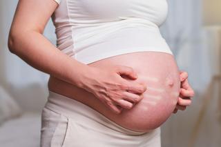 Atopowe zapalenie skóry w ciąży: jak sobie z nim radzić?