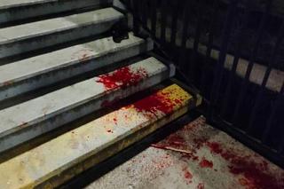 Zmasakrował starszego mężczyznę na kładce! Koszmar w Bydgoszczy [ZDJĘCIA]