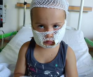 Amstaff rozszarpał buzię 4-letniej Nadii. Nic nie zapowiadało tragedii