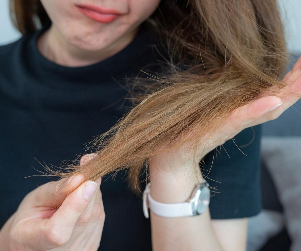 Kobieta trzyma w dłoniach swoje włosy, prezentując ich zniszczone i przesuszone końcówki. Wygląda na zmartwioną i zastanawia się, jak poprawić ich kondycję. Więcej o problemach z wypadaniem włosów po lekach na otyłość przeczytasz na Poradnik Zdrowie.