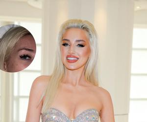 Caroline Derpienski bez makijażu. Tak wygląda jej twarz bez filtrów