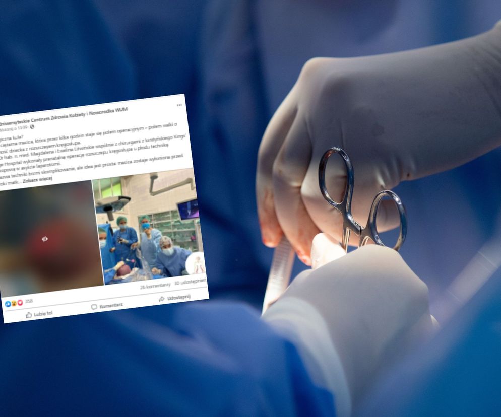 Magiczna kula? Nie, to ciężarna macica. Niezwykła operacja w Warszawie