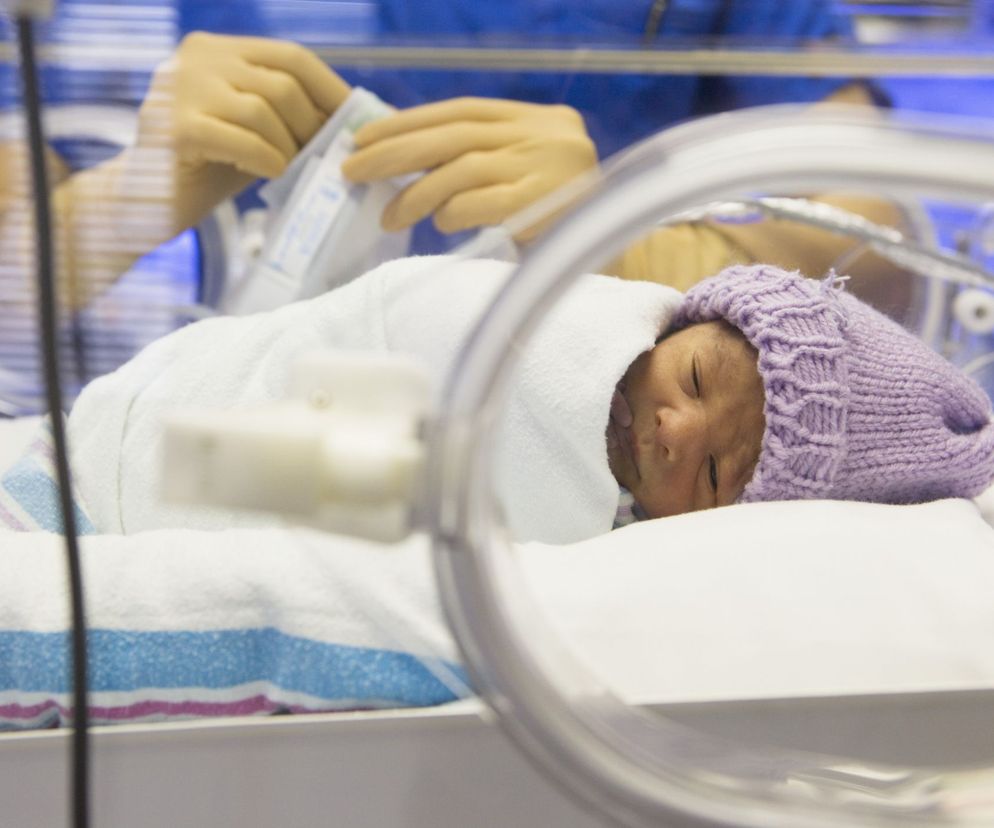 Im dziecko wcześniej się urodzi, tym prawdopodobieństwo wystąpienia żółtaczki fizjologicznej jest większe.