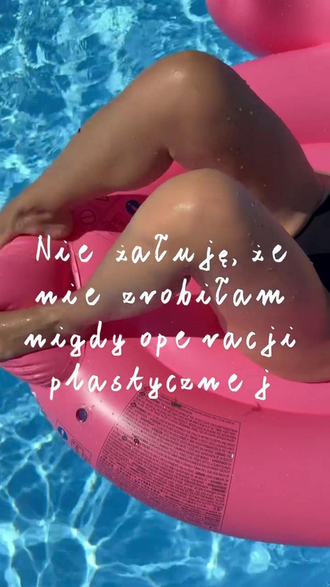 Dorota Szelągowska nie wstydzi się rozstępów