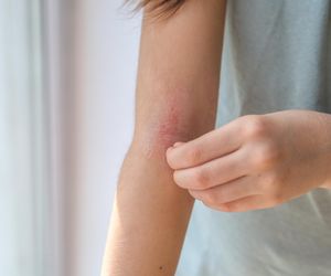 Bolesne wysypki i rany? Sprawdź, jak pielęgnować skórę w trakcie leczenia raka, by poczuć ulgę