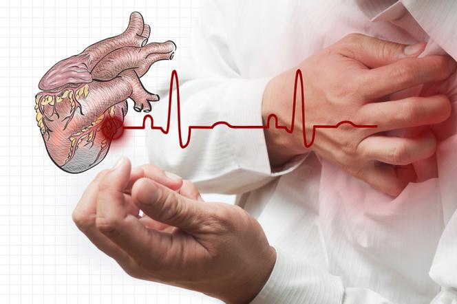 Choroby serca. Jakie choroby serca mogą zacząć ci dokuczać wraz z wiekiem? 