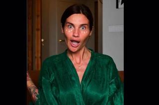  Przeraźliwie chuda Karolina Gilon