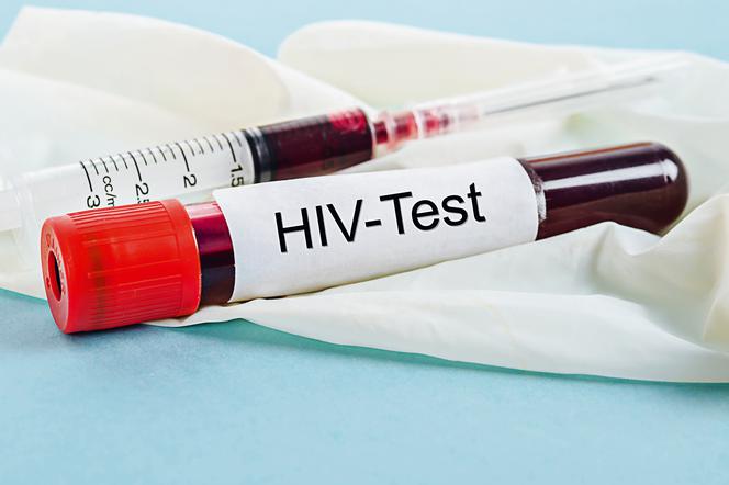 test na HIV ampuiłka