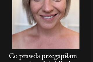 Szelągowska pokazała zmarszczki nie zgadniesz do czego je porównała.