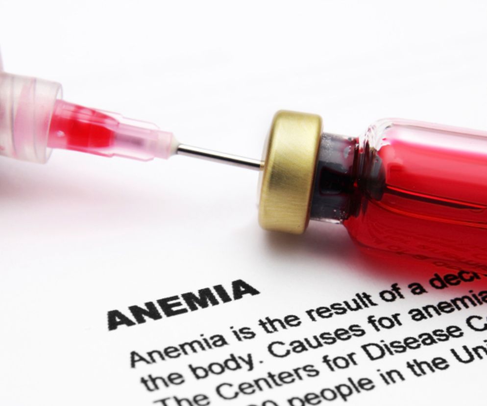 Niedokrwistość (anemia) złośliwa - przyczyny i objawy. 
 Jak przebiega leczenie anemii złośliwej?