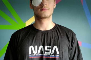 Gwóźdź wbił się w jego oko 20-letniego strażaka OSP. Teraz Kacper ma jedno marzenie [ZDJĘCIA]