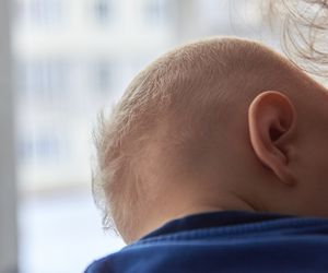 Zespół Aperta - przyczyny, objawy, leczenie