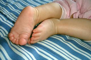 Platfus – jak korygować płaskostopie u dziecka?