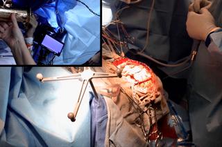 Grał na saksofonie, gdy operowali mu mózg