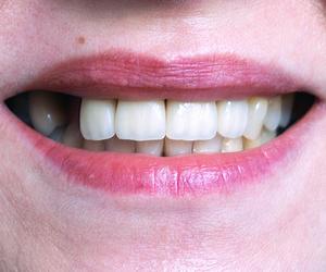 Będzie lek na odrastanie utraconych zębów. Naukowcy wskazali datę